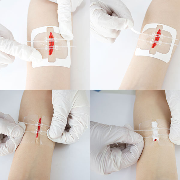 Band Aid Longmed Wound Closure Strips