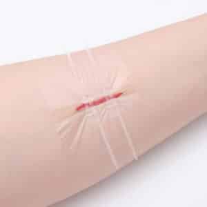 Band Aid Longmed Wound Closure Strips Longmed Medical