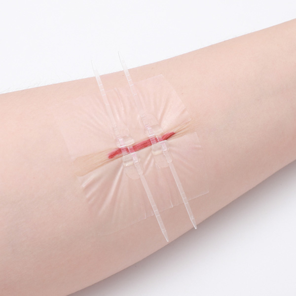Tiras de fechamento de feridas com ponto zip Longmed Band Aid