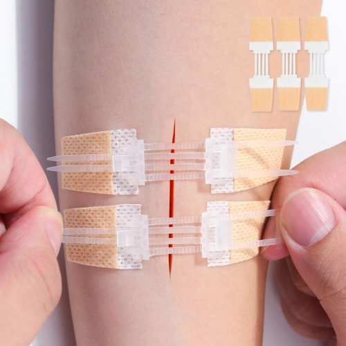 Wound Scar Treatment Zip Stitch Wound Closure Strip