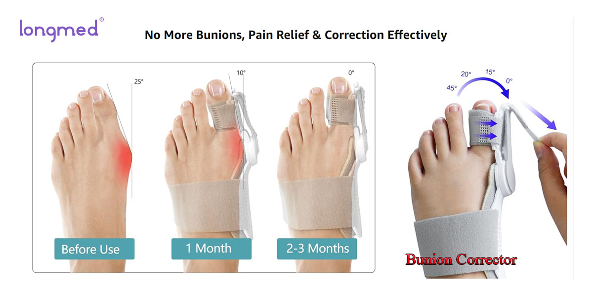 Longmed Bunion Corrector Hallux Valgus Corector Îndreptat ortopedic pentru degetele de la picioare